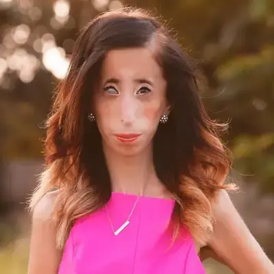 Lizzie Velásquez